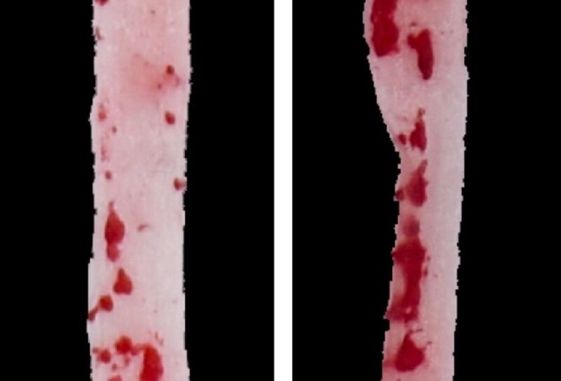 Popularny zamiennik cukru może uszkadzać naczynia krwionośne